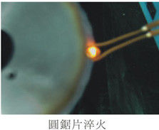 अति उच्च आवृत्ति 1-2 मेगाहर्ट्ज़ इंडक्शन मेल्टिंग उपकरण